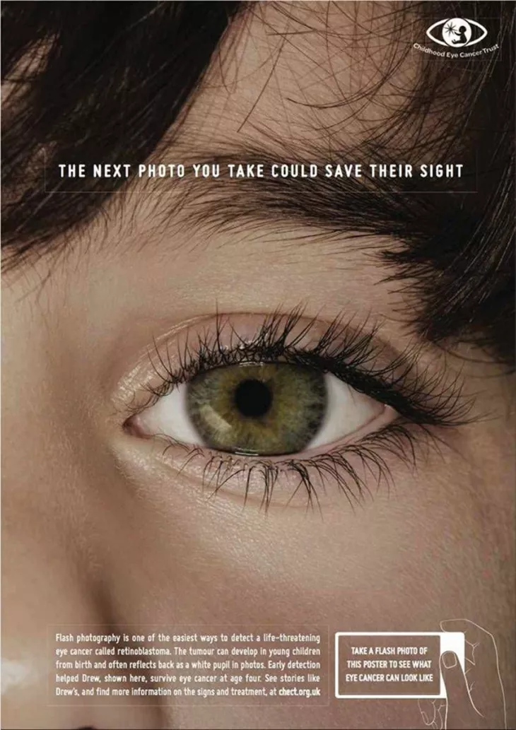 Childhood Eye Cancer Trust ads